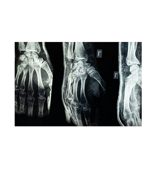 rx-image